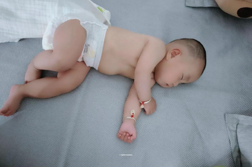西安六个月宝宝眼睛散光